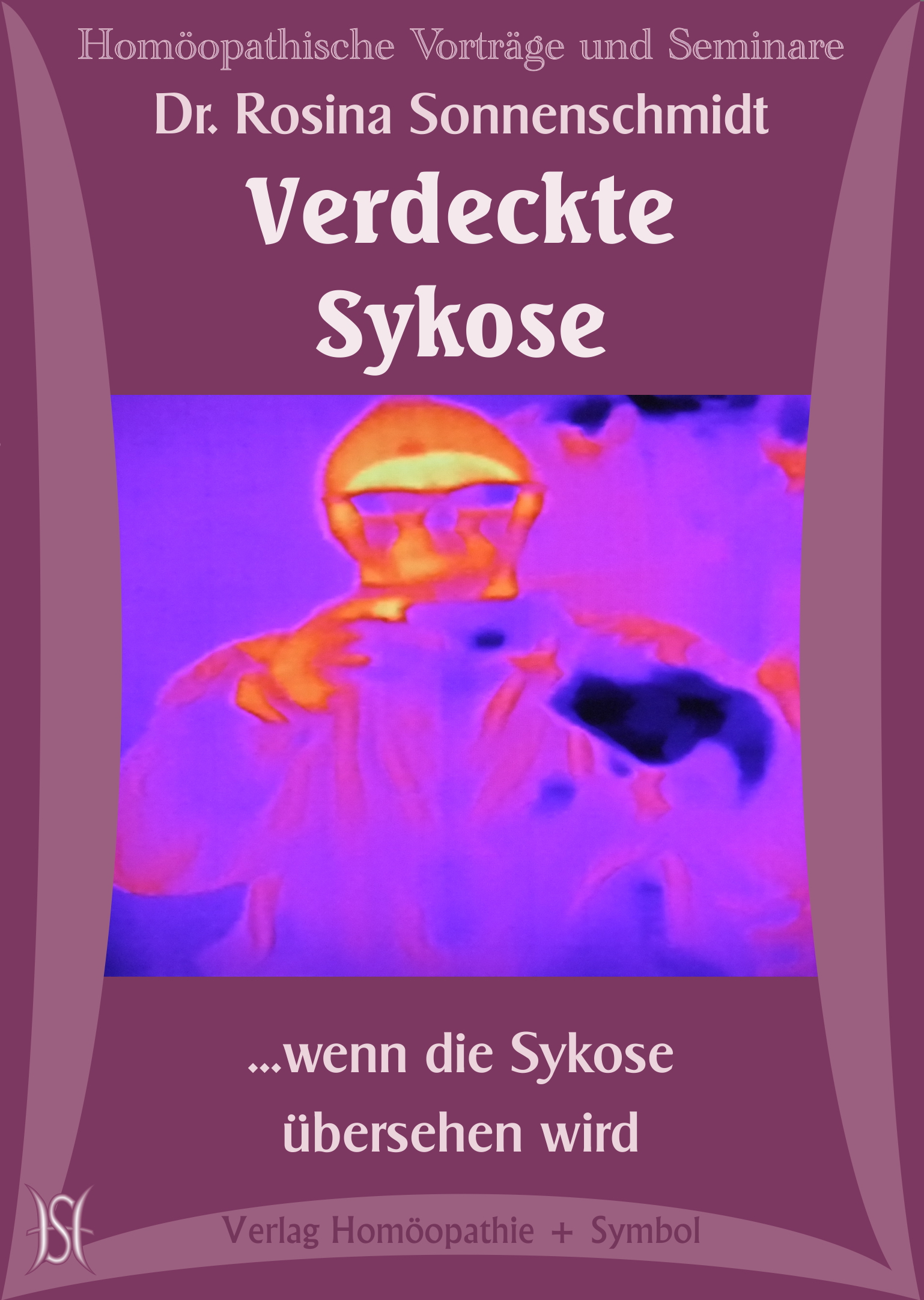 Verdeckte Sykose - ...wenn die Sykose übersehen wird