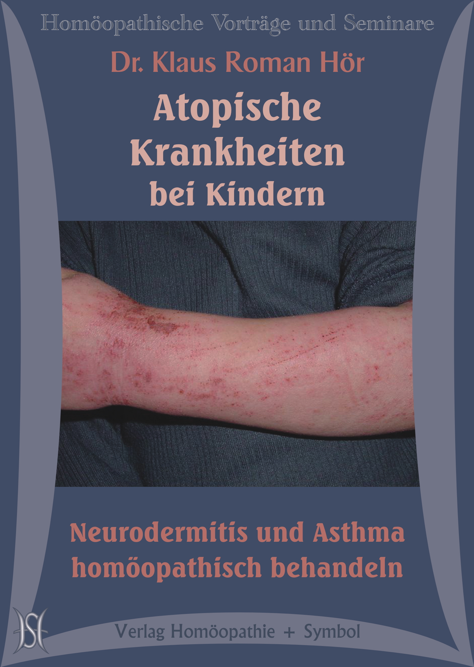 Atopische Krankheiten bei Kindern: Neurodermitis und Asthma homöopathisch behandeln