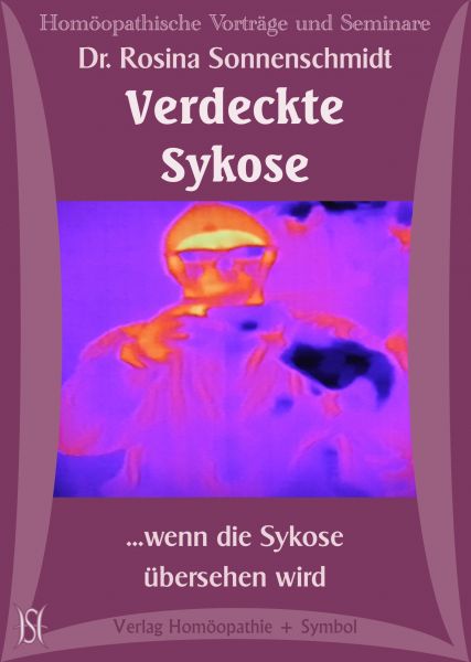 Verdeckte Sykose - ...wenn die Sykose übersehen wird