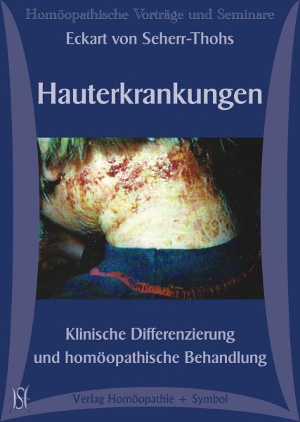 Hauterkrankungen - Klinische Differenzierung und homöopathische Behandlung